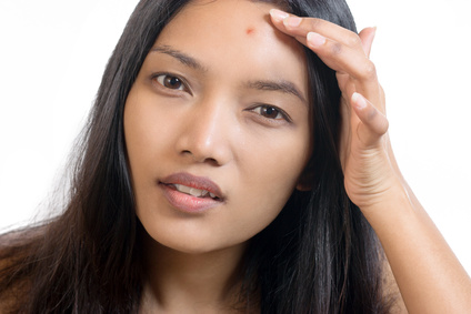 Woman finding an acne on her forehead