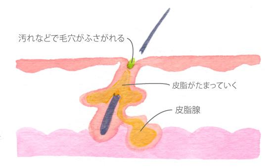 image12